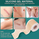 Load image into Gallery viewer, Silicone Scar Tape, Silicone Scar-- FREE EXPRESS DELIVERY🎁