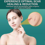 Load image into Gallery viewer, Silicone Scar Tape, Silicone Scar-- FREE EXPRESS DELIVERY🎁