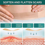 Load image into Gallery viewer, Silicone Scar Tape, Silicone Scar-- FREE EXPRESS DELIVERY🎁
