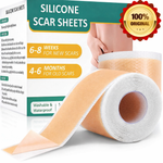Load image into Gallery viewer, Silicone Scar Tape, Silicone Scar-- FREE EXPRESS DELIVERY🎁
